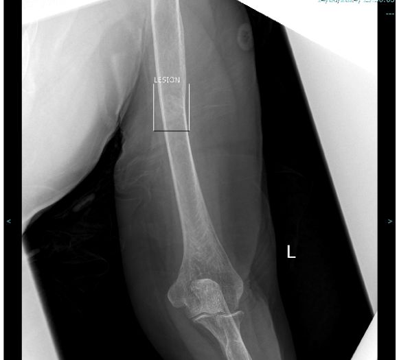 IA radiologia falso diagnostico